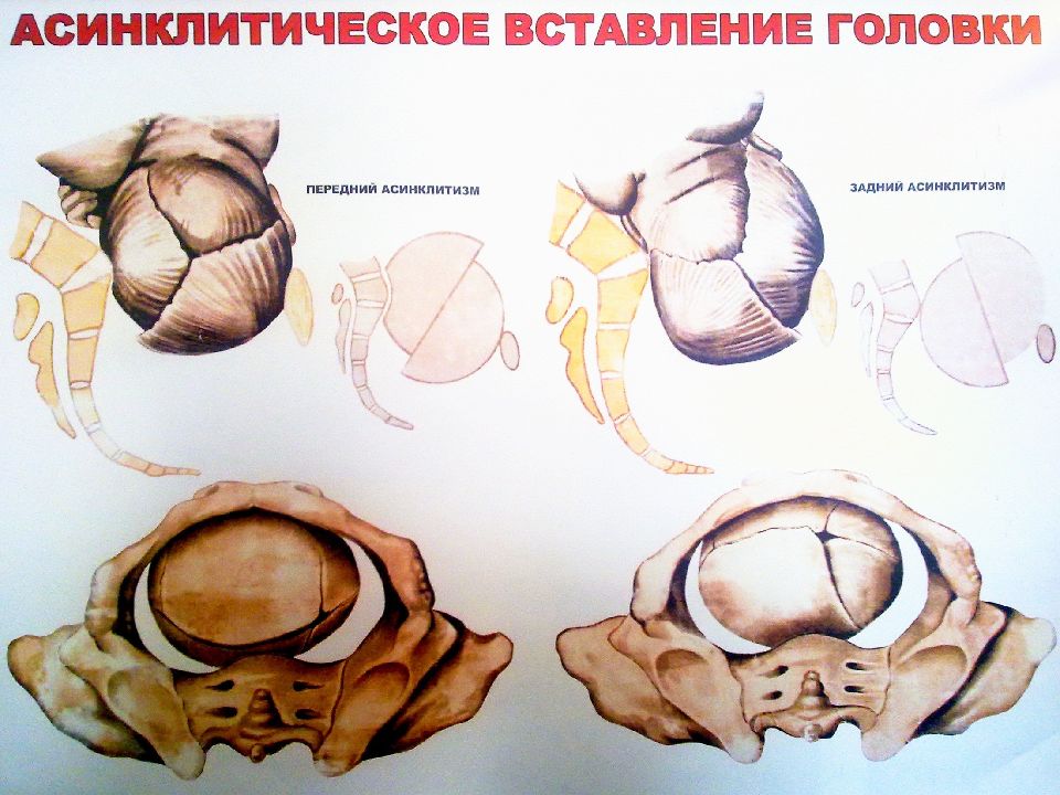 Разгибательные вставления головки плода презентация