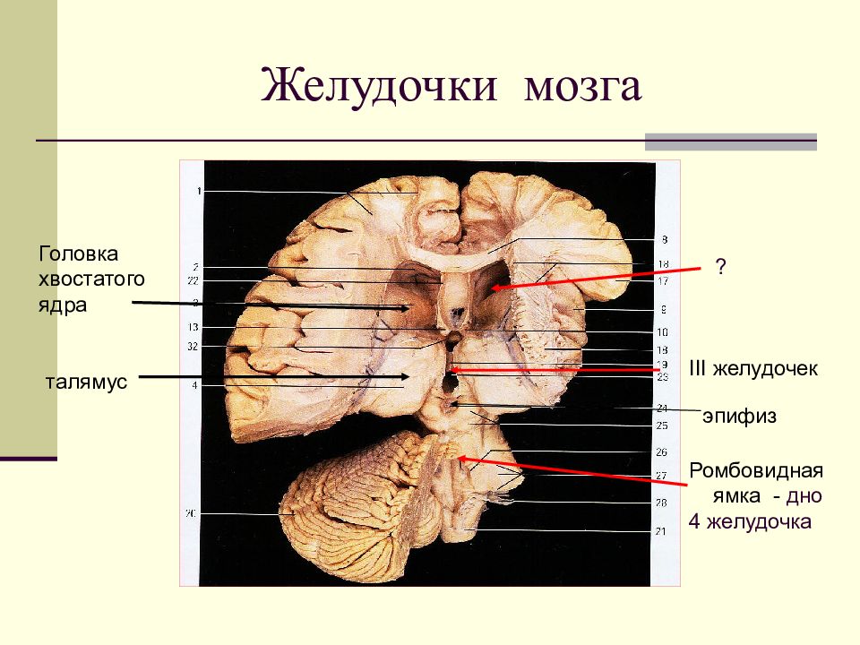 Образования желудочков мозга. Третий желудочек головного мозга анатомия. 4 Желудочек головного мозга. Проекция желудочков мозга вид слева. Схема желудочков головного мозга.