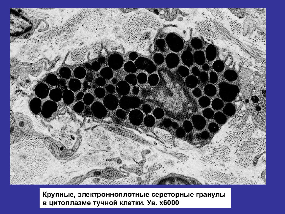 Тучные клетки фото под микроскопом