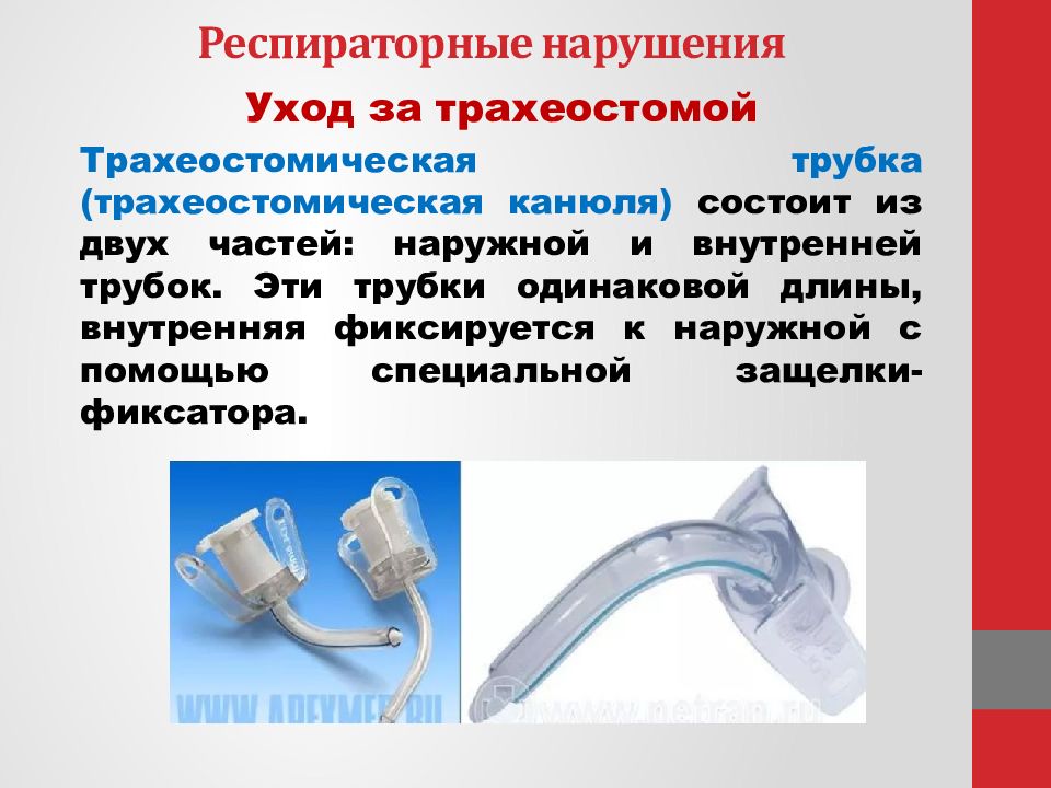 Трахеостома уход. Обработка внутренней трахеостомической трубки. Трахеостомическая канюля строение. Строение трахеостомической канюли. Трахеостомическая трубка строение.