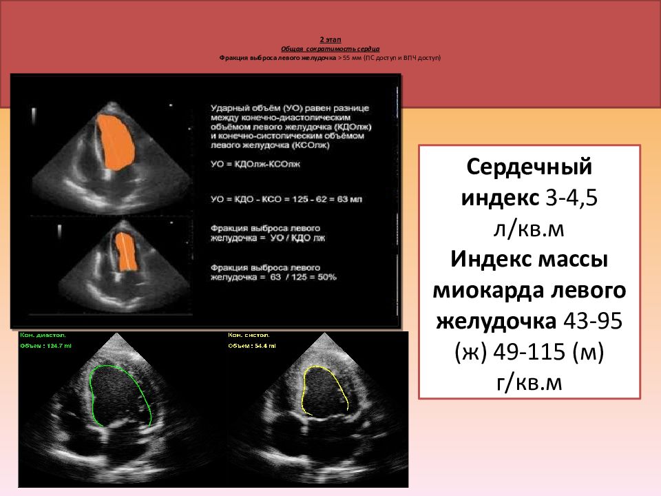 Фракция выброса при хсн. Измерение фракции выброса на эхокардиографии. Фракция выброса левого желудочка по Симпсону. Фракция выброса на ЭХОКГ. Фракция выброса по Симпсону на ЭХОКГ.