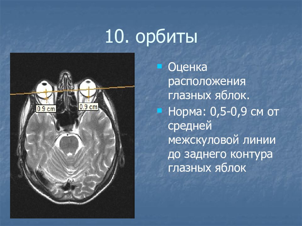 Мрт Орбит Глаз Цена К31