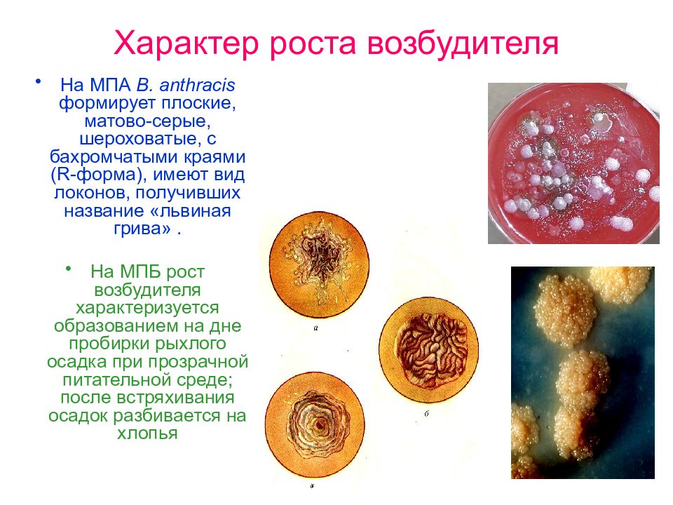 Презентация по микробиологии сибирская язва