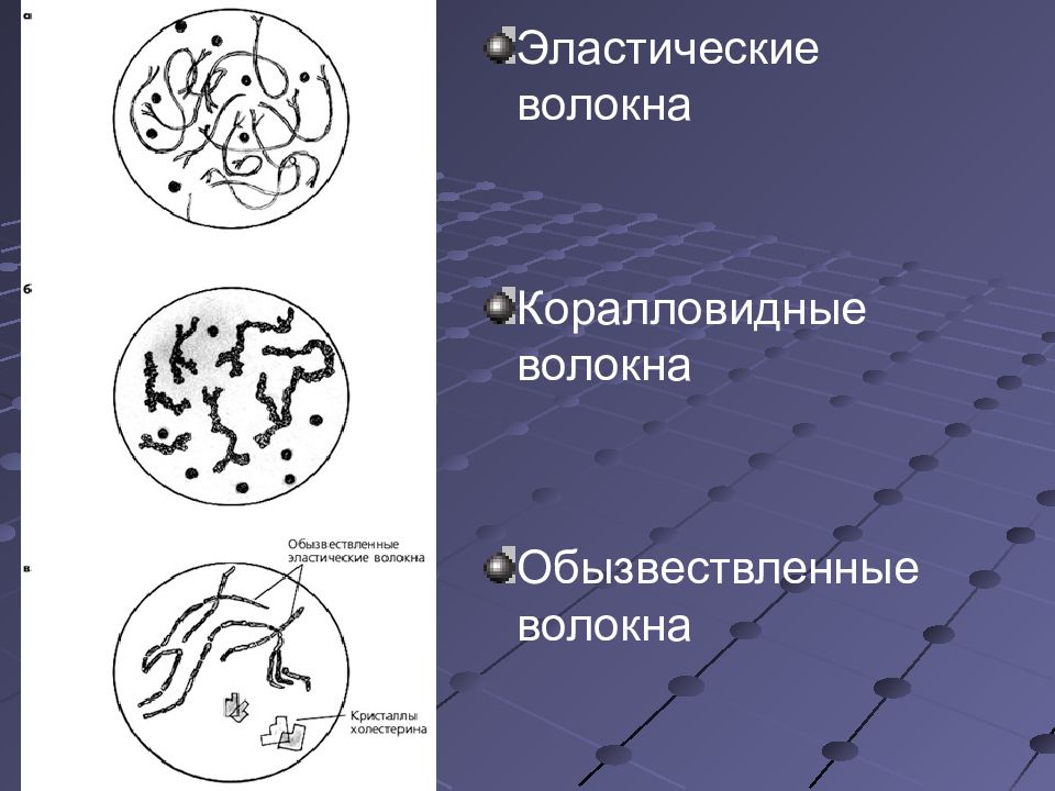 Микроскопия мокроты в картинках с описанием