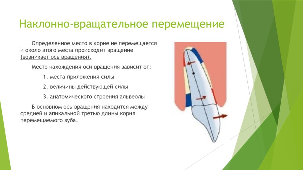 Перемещение 3. Наклонно вращательное перемещение зуба. Корпусное перемещение зуба. Типы перемещения зубов. Биомеханика ортодонтического перемещения зуба.