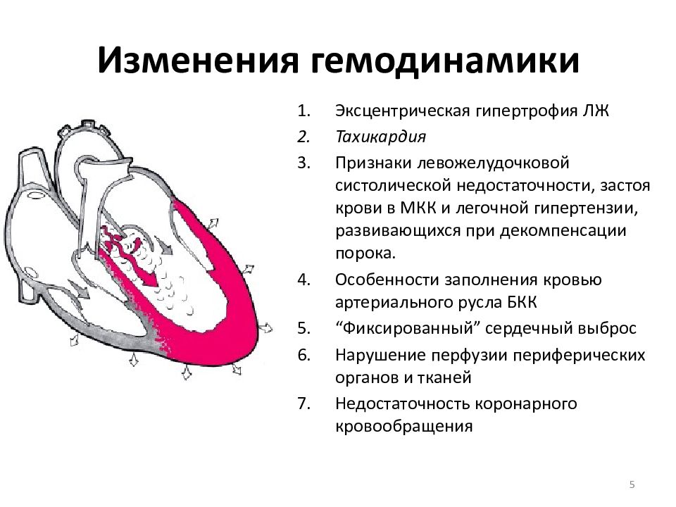 Аортальная недостаточность презентация