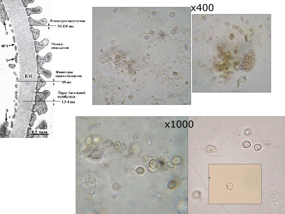 Микроскопия мочи. Микроскопия осадка мочи. Кандида в моче микроскопия. Слайд-планшет для исследования осадка мочи.