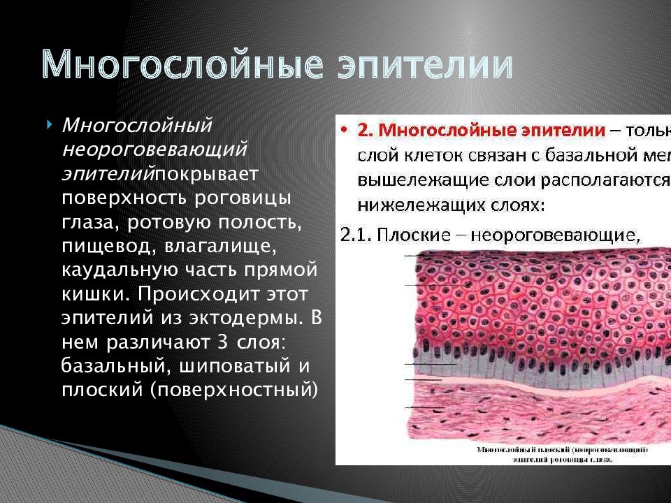 Эпителиальная атипия. Многослойный неороговевающий эпителий.