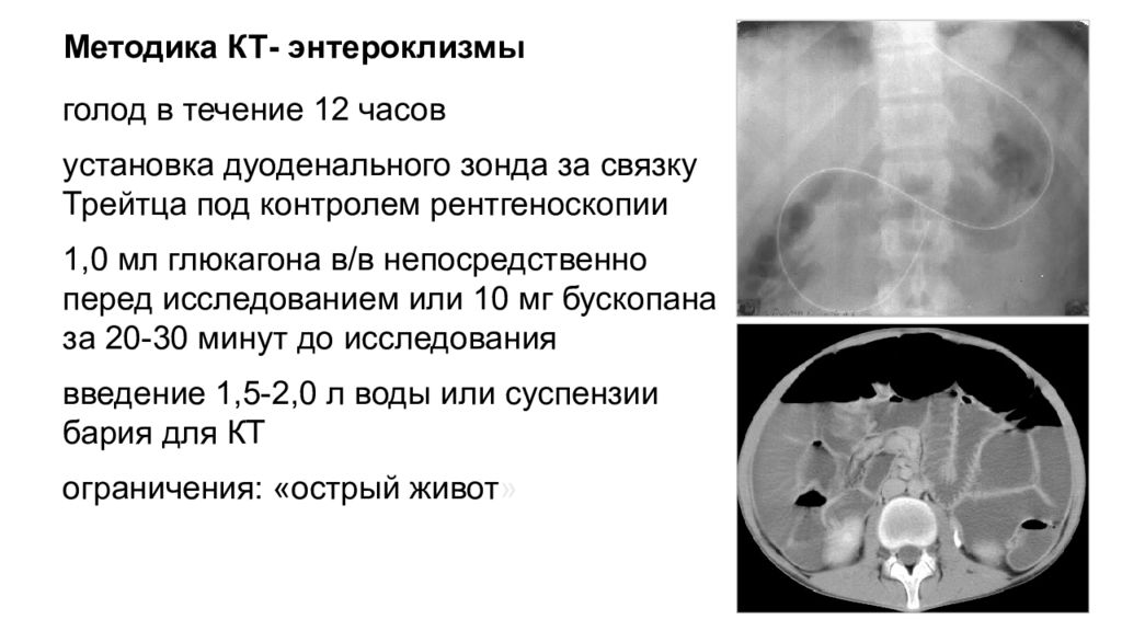 Можно пить перед кт брюшной полости