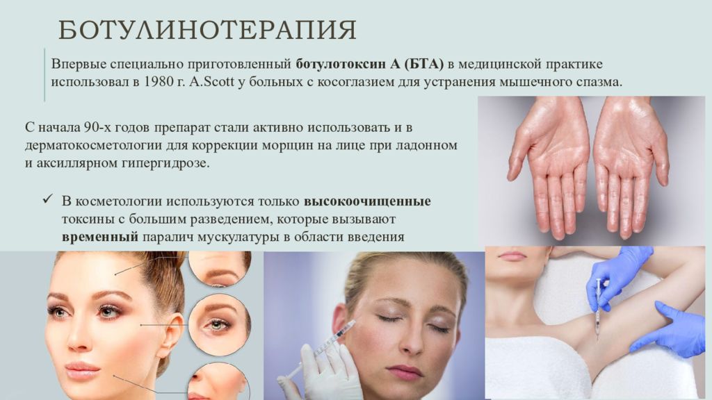 Ботулинотерапия от морщин skinlift ru