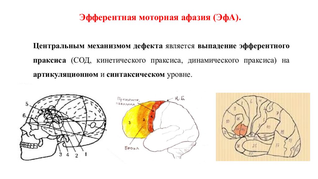 Эфферентная моторная афазия презентация