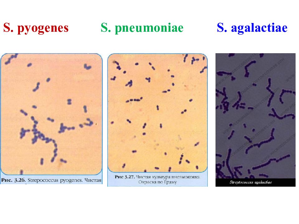 Streptococcus agalactiae