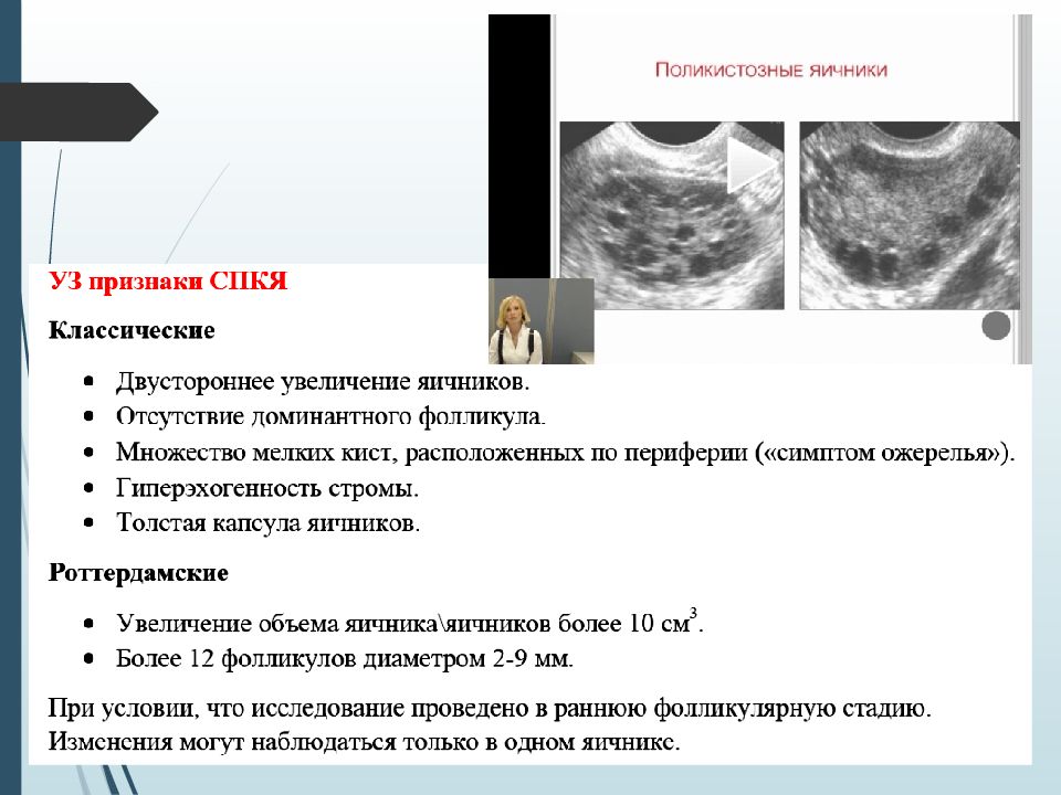 Поликистоз яичников картинки