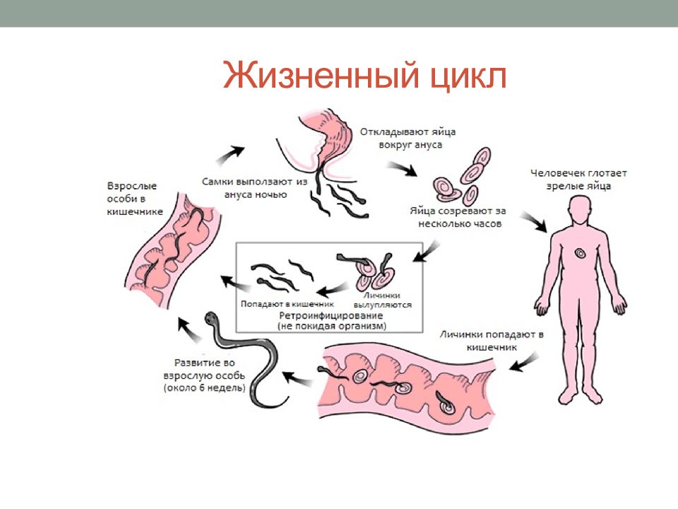 Презентация про энтеробиоз