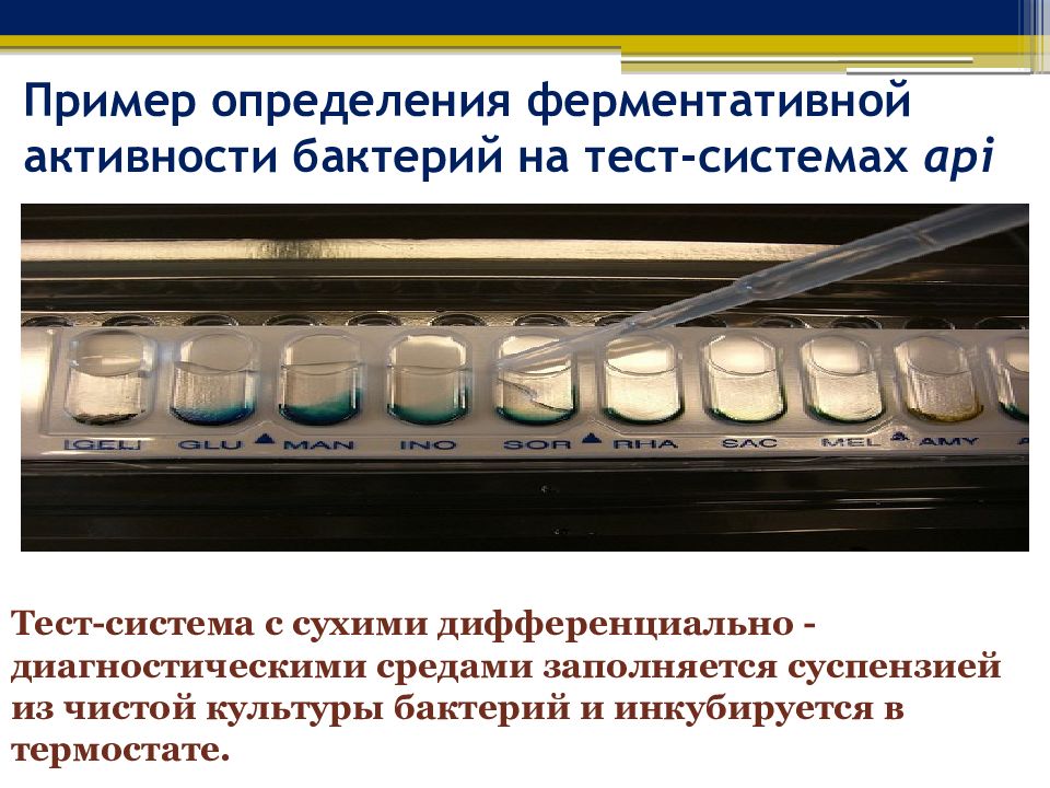 Ферментативная активность бактерий. Определение ферментативной активности бактерий. Ферментативность микроорганизмов. Тест системы бактерии.