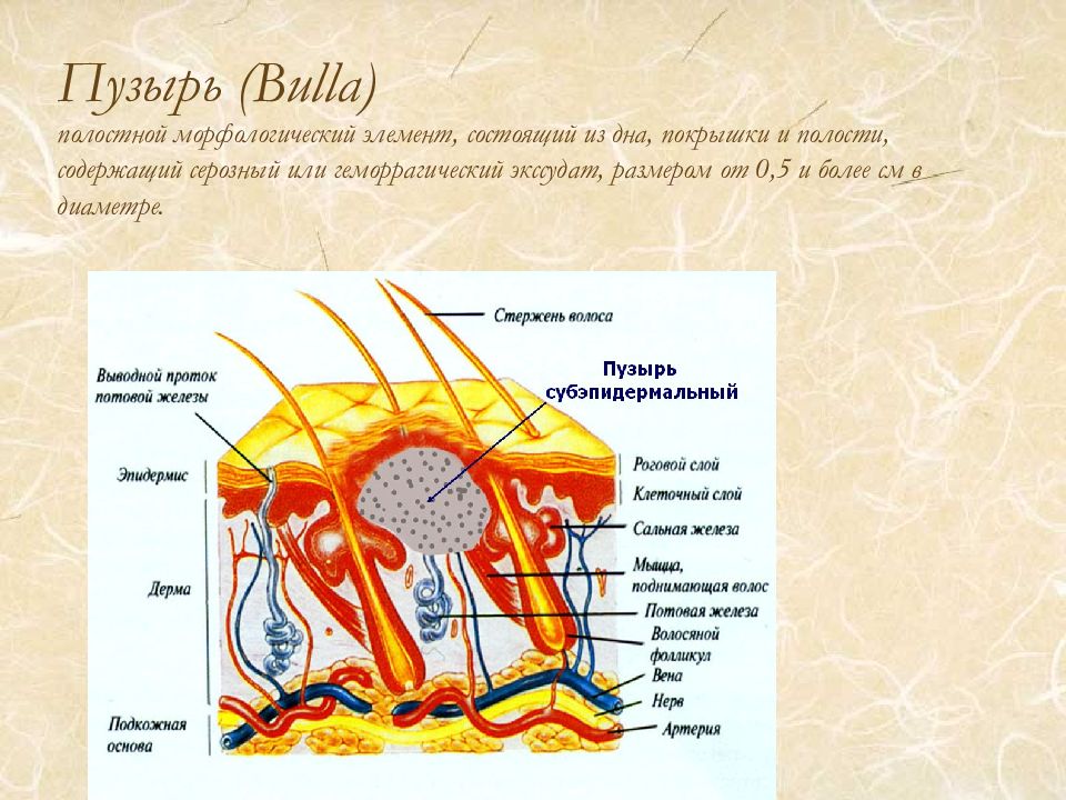 Волдырь элемент. Полостные элементы кожи. Морфологические элементы кожи. Первичные полостные морфологические элементы кожи.