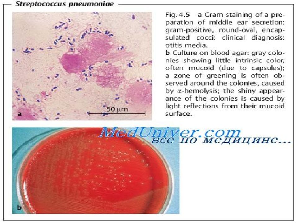 Пневмококк антибиотик. Пневмококк диагностика. Лабораторная диагностика пневмококка. Микробиологическая диагностика пневмококковой инфекции. Streptococcus pneumoniae источник инфекции.