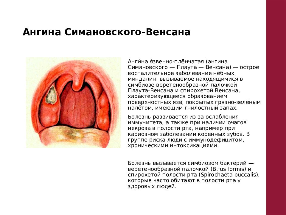 Осложнения ангины