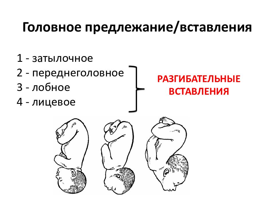 Биомеханизм родов при заднем виде затылочного предлежания презентация