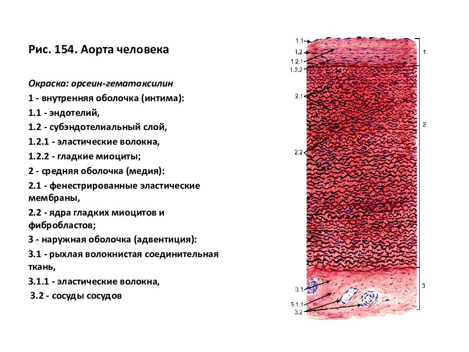 Мышечная стенка сосудов. Артерия эластического типа аорта препарат. Препарат аорта окраска гематоксилин. Аорта орсеин гистология препарат. Препарат аорта гистология окраска орсеином.