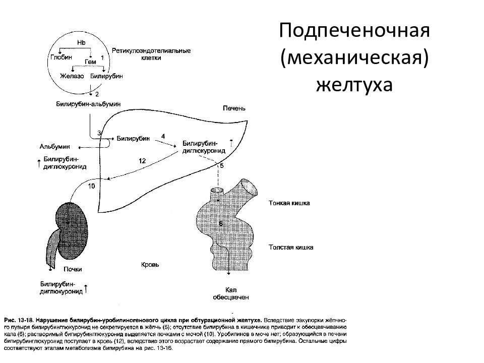 Паренхиматозная желтуха схема