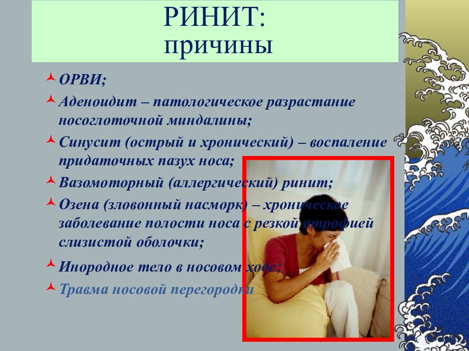 Насморк симптомы. Причины аллергического ринита у взрослых. Причины острого ринита.