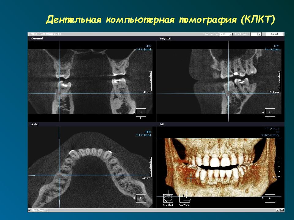 Лучевая диагностика нервной системы презентация