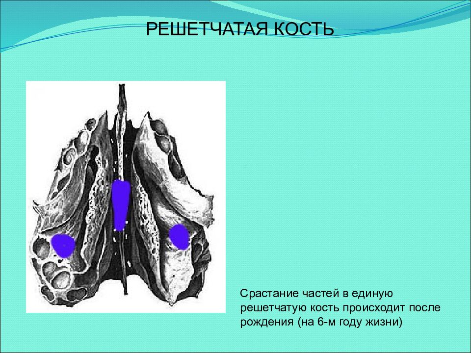 Продырявленная пластинка решетчатой кости. Решетчатая кость решетчатой кости. Полулунная расщелина решетчатой кости. Решетчатая кость вертикальная пластинка. Решетчатый пузырек решетчатой кости.