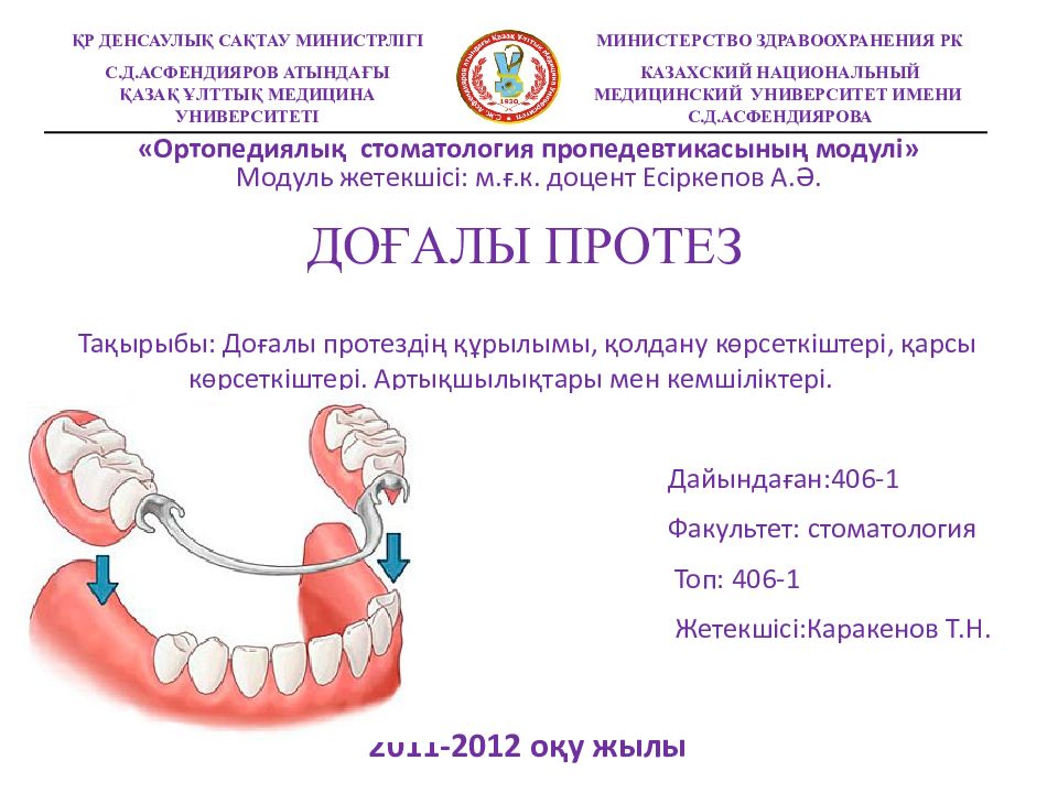 Тақырыбы: Доғалы протездің құрылымы, қолдану көрсеткіштері, қарсы