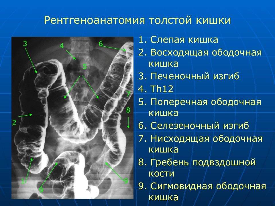 Селезеночный угол толстого