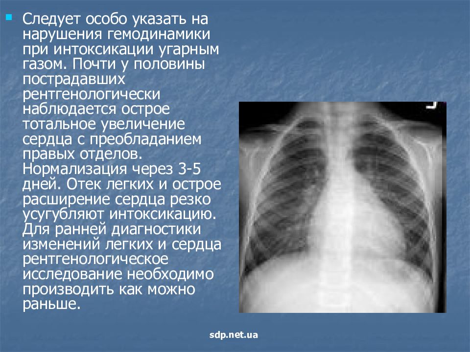 Какой цвет кожи при отравлении угарным газом. Изменения в легких при отравлении угарным газом. Кожные покровы при отравлении угарным газом. Презентация на тему отравление угарным газом. Диагностирование отравления угарным газом.