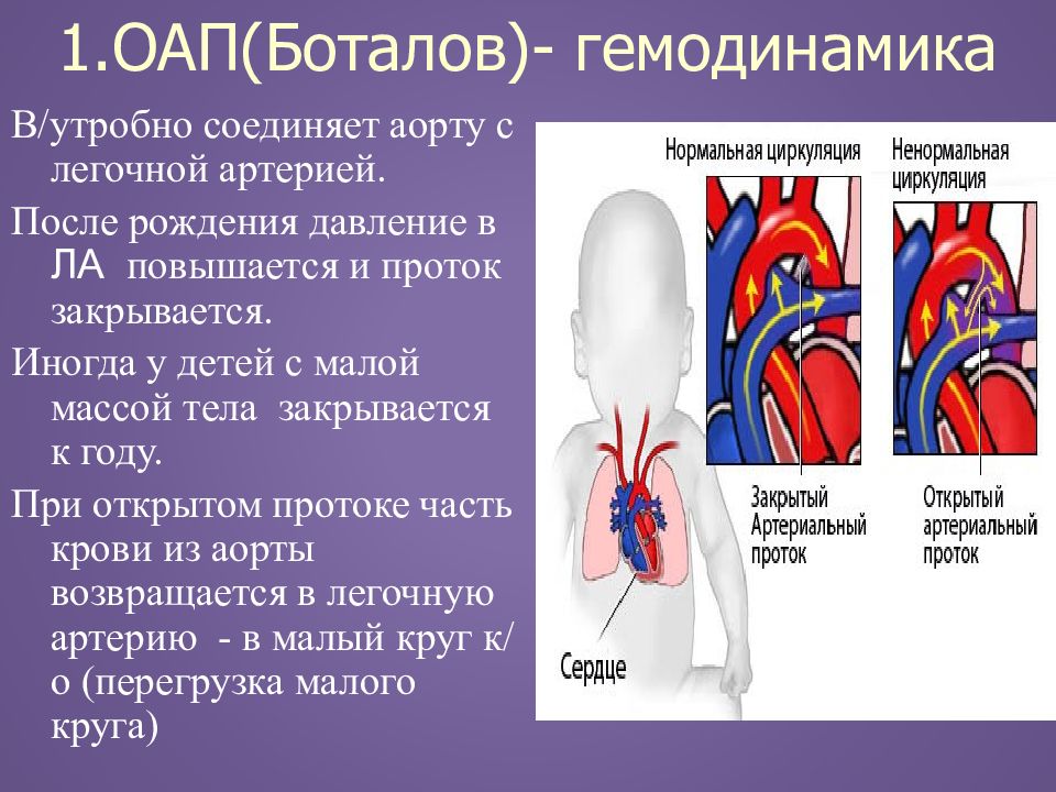 Открытый артериальный проток у детей презентация