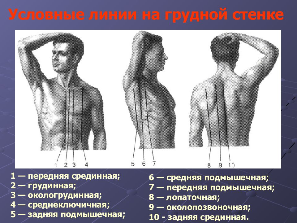 Линии туловища. Условные линии на грудной стенке. Условные линии на грудной клетке анатомия. Топографические линии грудной клетки. Линии на грудной клетке пропедевтика.