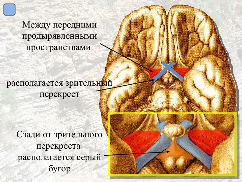 Расположиться. Зрительный Перекрест головного мозга. Сосцевидные тела и серый бугор. Хеазма зрительного бугр. Зрительный Перекрест гипоталамуса.