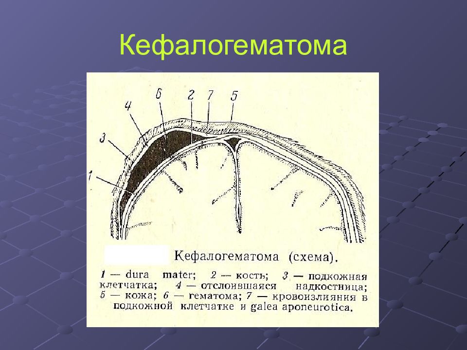 Картинки родовая опухоль