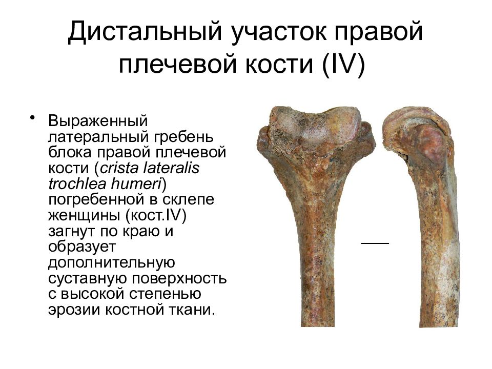 Анатомические образования на дистальном конце плечевой кости