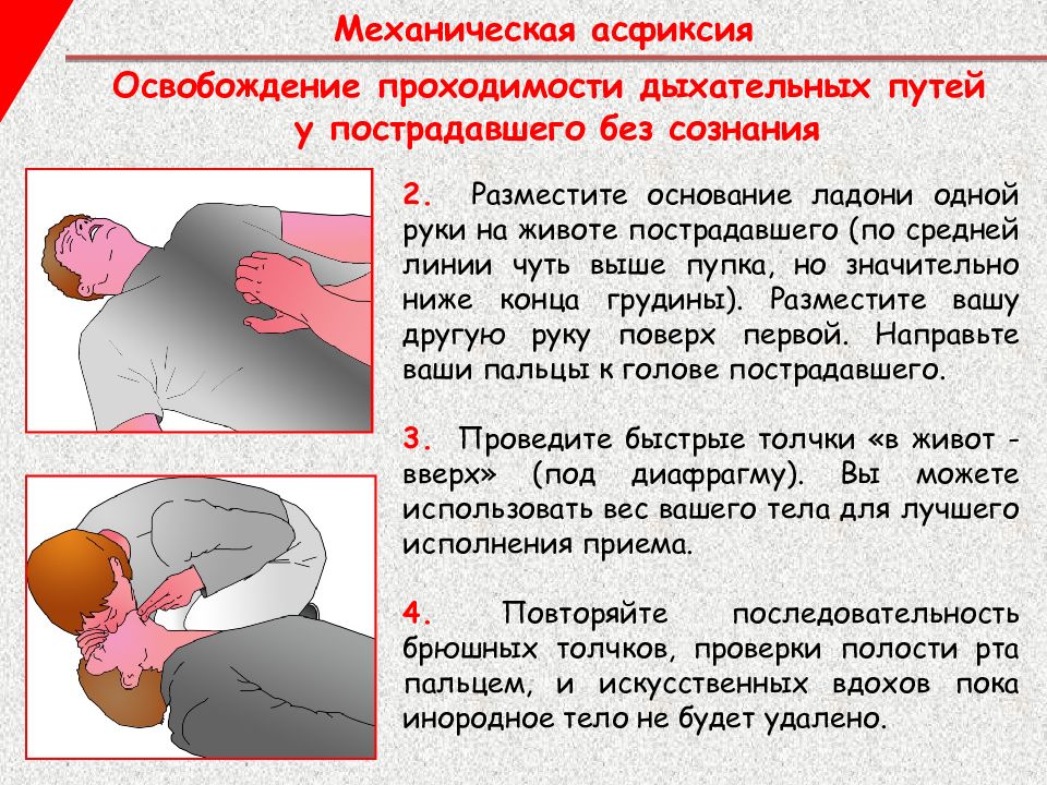 Механическая асфиксия первая помощь презентация