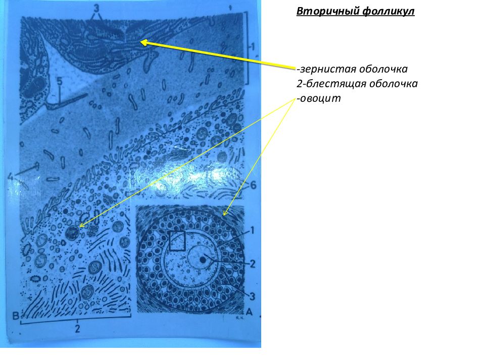 Зернистая оболочка. Фолликул с блестящей.оболочкой. Зернистая оболочка фолликула. Бокаловидные клетки альциановый синий.