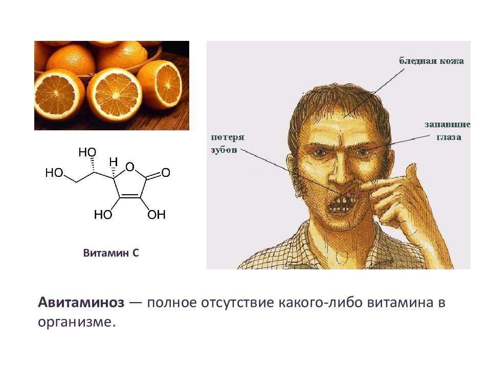 Ферменты химия 10 класс презентация