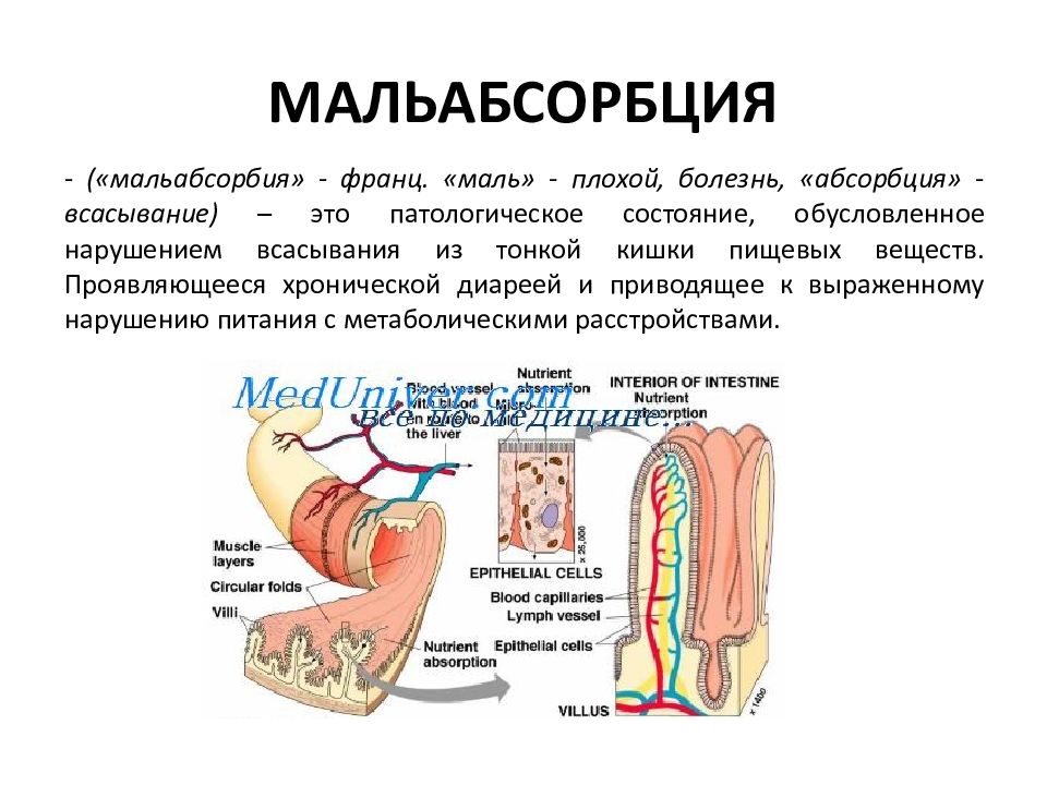 Презентация на тему болезни кишечника