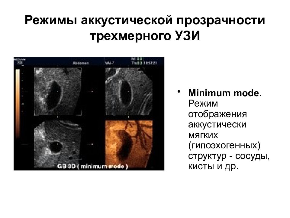 Презентация на тему узи