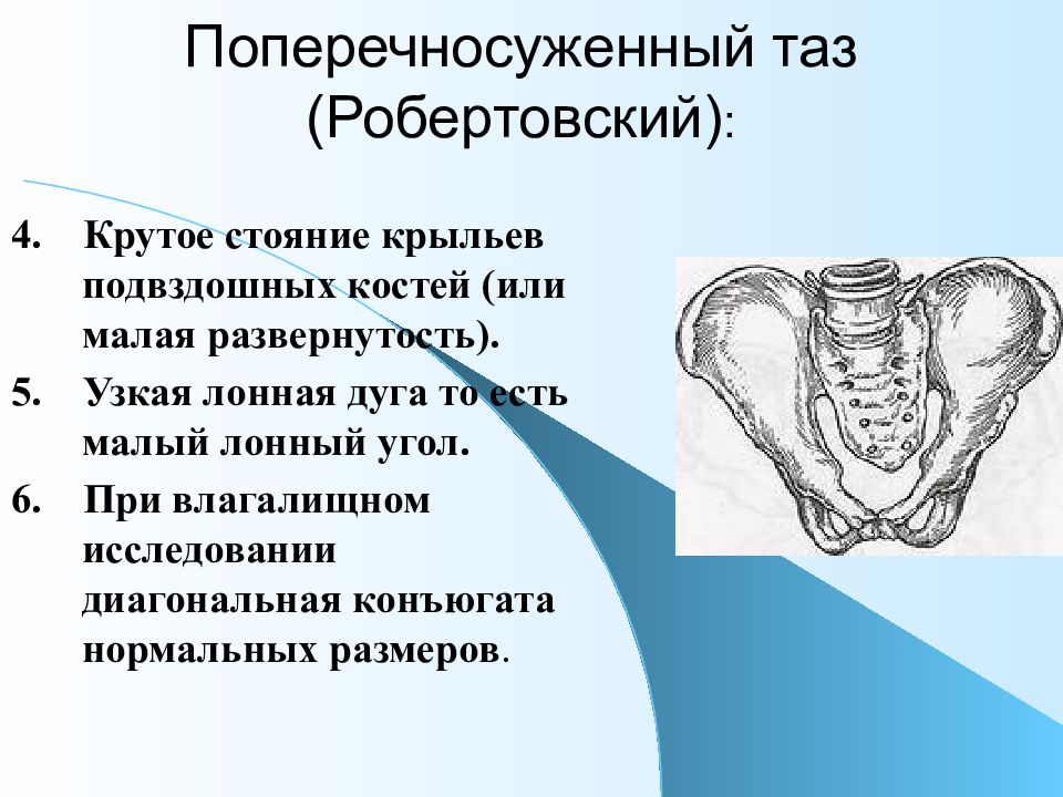 Размеры женского таза презентация