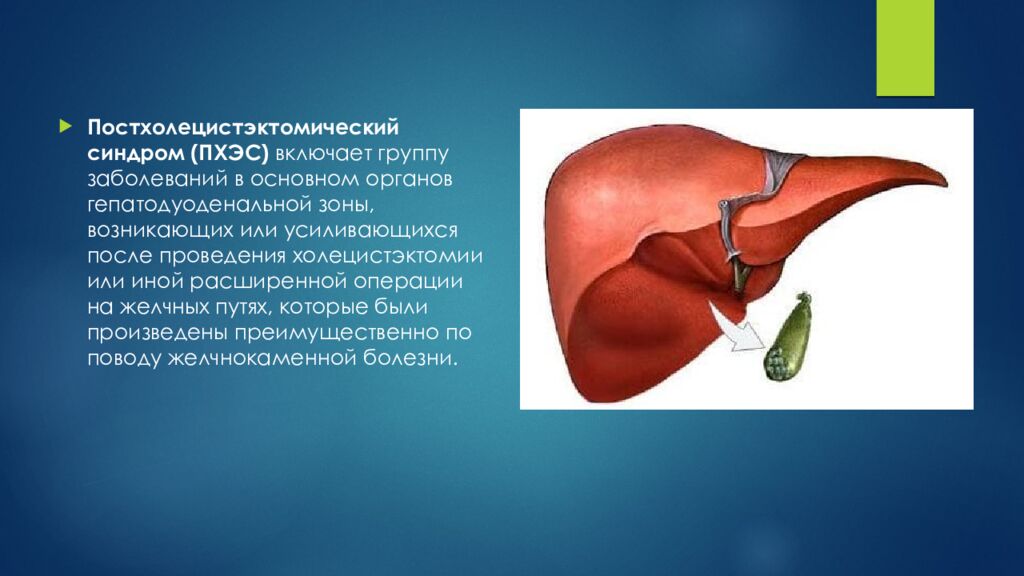 Постхолецистэктомический синдром