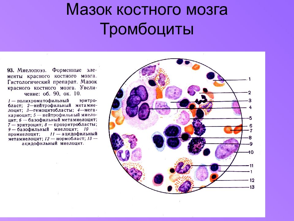 Красный мозг препарат. Гистологический препарат мазок красного костного мозга. Срез красного костного мозга гистология. Мазок красного костного мозга гематоксилин эозин. Красный костный мозг гистология препарат.