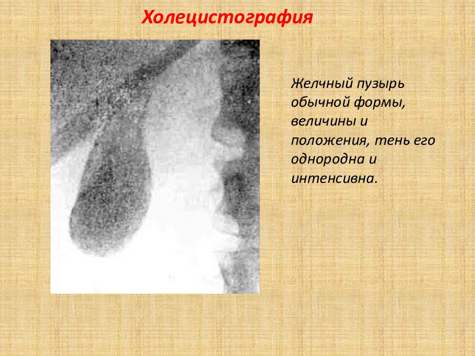 Холецистография направление образец