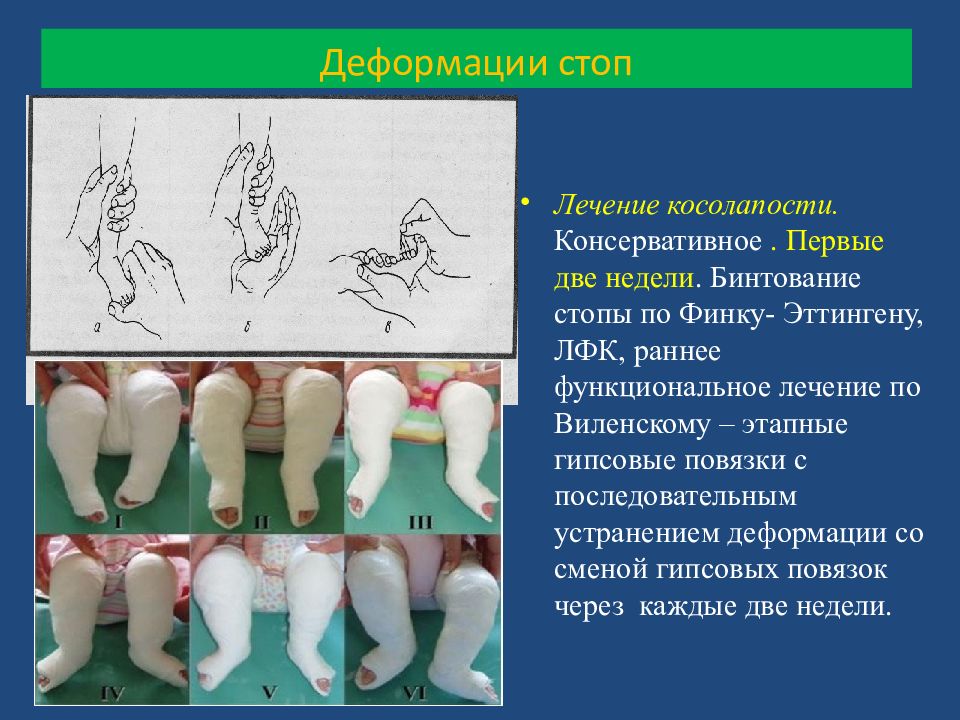 Всемирный день косолапости 3 июня картинки с надписями