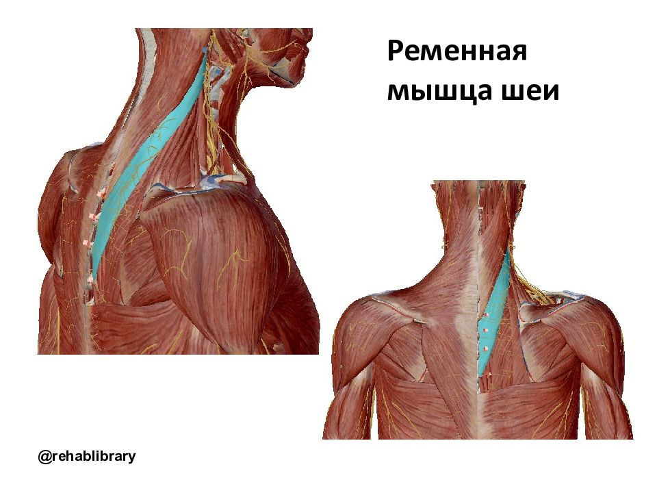 Ременная мышца. Ременная мышца шеи иннервация. Ременная (пластырная) мышца шеи. Ременная мышца головы (m. splenius capitis). Мышцы спины ременная мышца шеи.