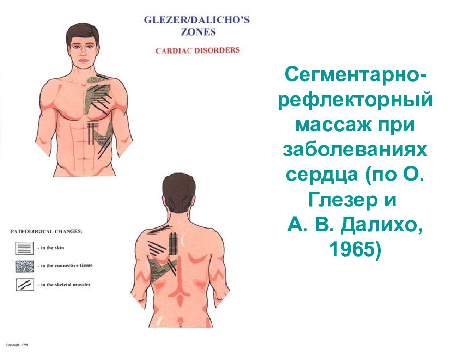 Сегментарно рефлекторный массаж презентация