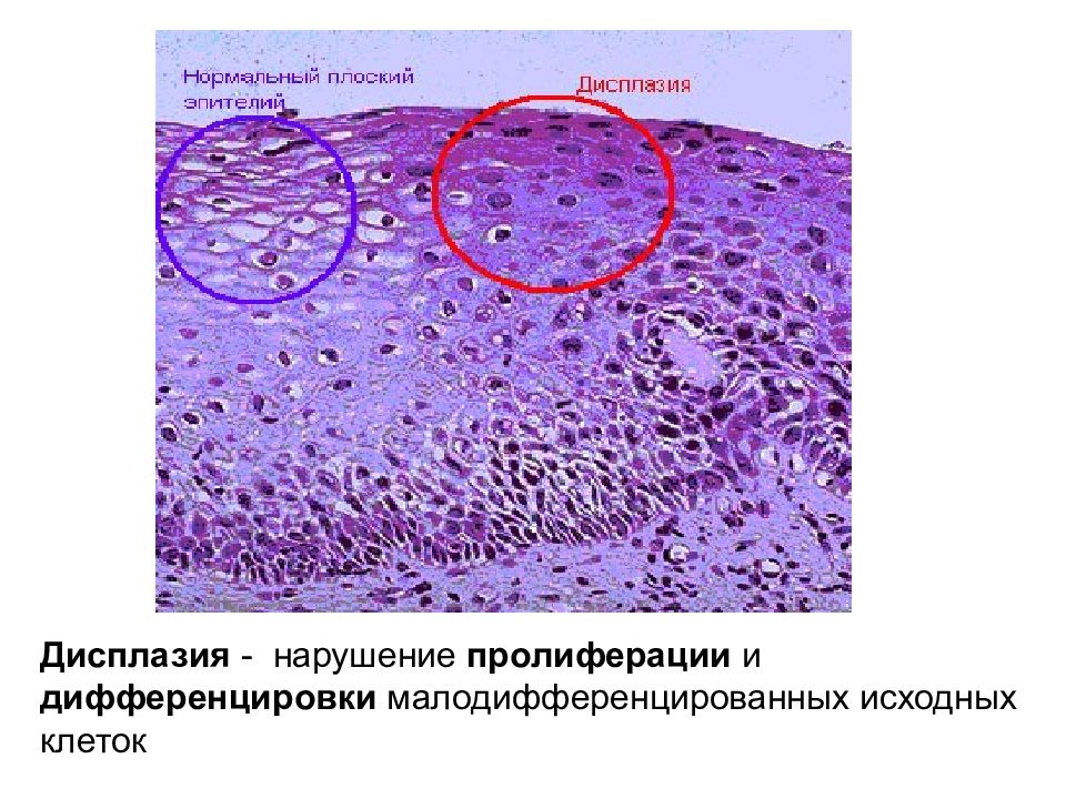 Исходная клетка. Малодифференцированные клетки. Пролиферация и дифференцировка. Нарушение дифференцировки клеток. Пролиферация и дифференцировка клеток.