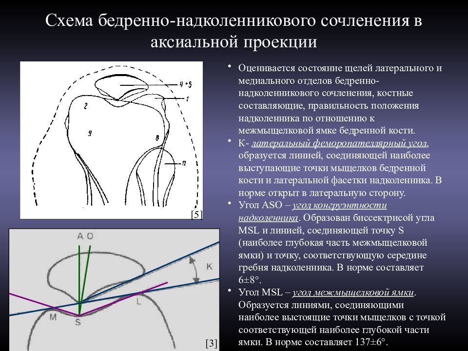 Медиальная фасетка надколенника на картинке